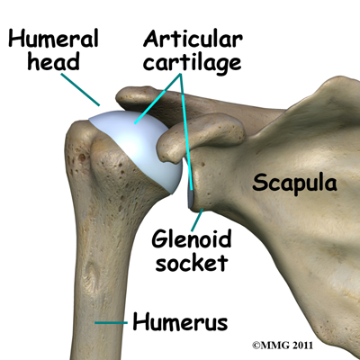 Physical Therapy in Baton Rouge for Osteonecrosis of Humeral Head